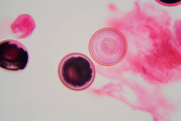 istock Eggs of a Taenia tapeworm 918829544