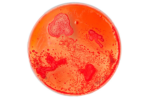 red petri dish with bacteria and yeast colonies growing, isolated on a white background.