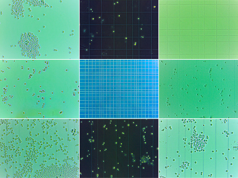 Collage of nine microscopic views of yeasts and thoma chamber grid.