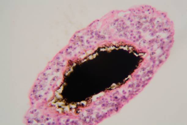 istock Schistosoma mansoni under the microscope 918881582