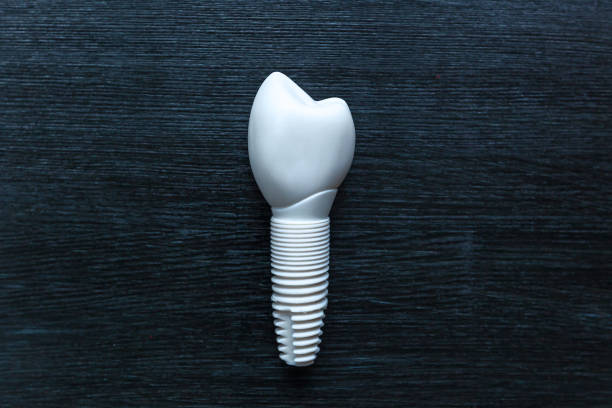 zahn-prothese. - laboratory dentures dental hygiene human teeth stock-fotos und bilder