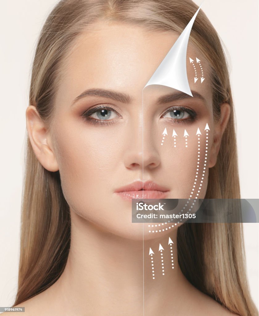 The young female face. Antiaging and thread lifting concept The young female face. Antiaging and thread lifting concept. The portrait of beautiful woman with problem and clean skin, aging and youth concept, beauty treatment and lifting. Before and after concept Adult Stock Photo