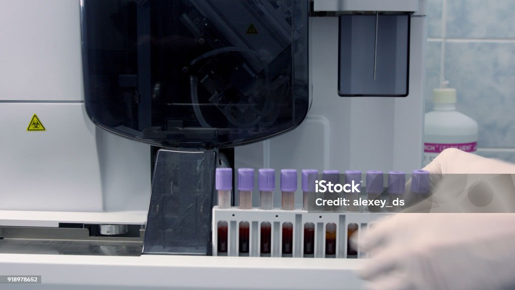 Medical Analyzer With Blue Loading Racks Rack With Blood Samples In Hematology Analyzer Stock Photo - Download ...