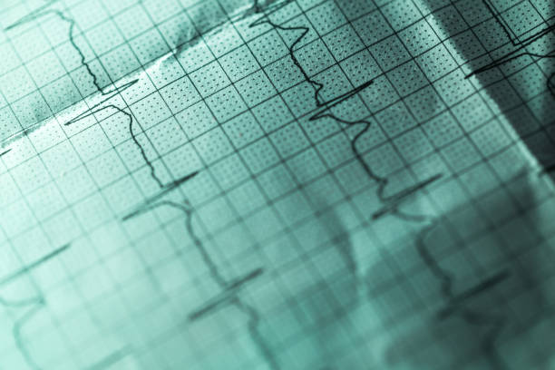istock heart Electrocardiogram on paper illuminated under green light 919584010