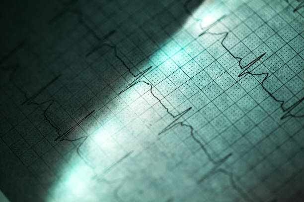 istock heart Electrocardiogram on paper illuminated under green light 919584370