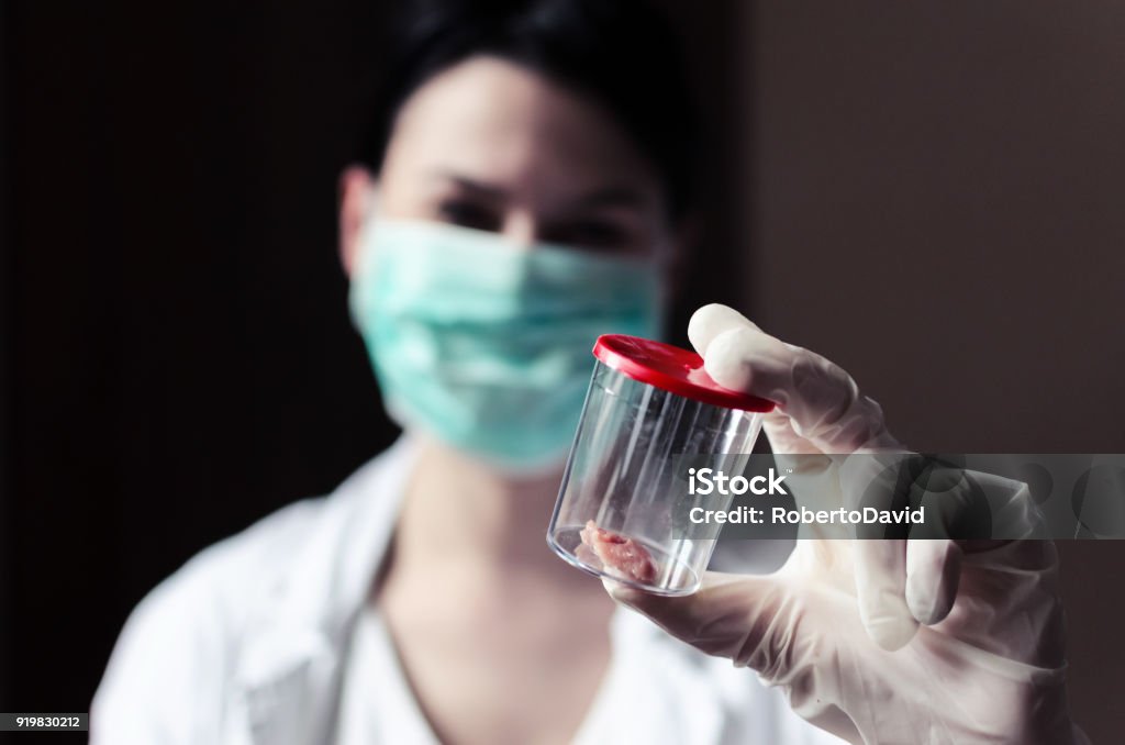 sample of tumors or cancers in the container Biopsy Stock Photo