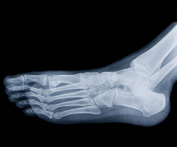 pied humain x-ray - bending human foot ankle x ray image photos et images de collection