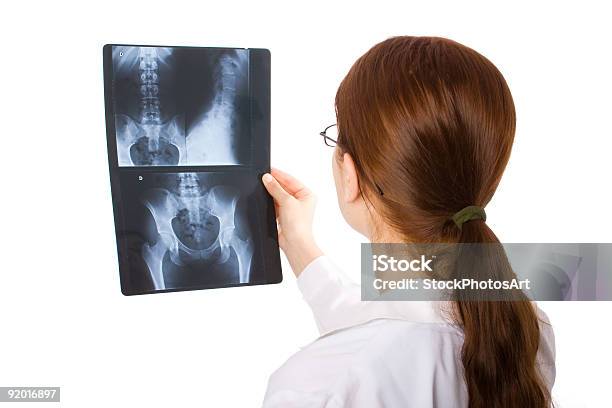 Foto de Feminino Médico e mais fotos de stock de Imagem de raios X - Imagem de raios X, Quadril, Raio X