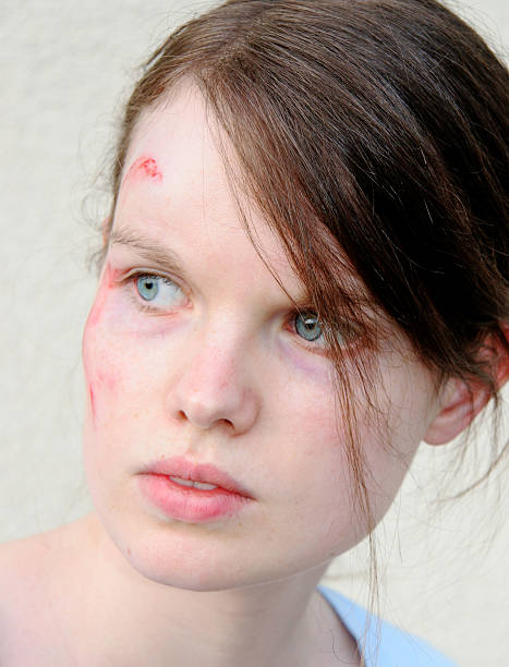 istock Injured woman 92023856