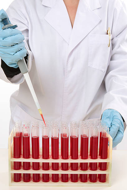 과학자간의 피펫을 사용하여 시료를 추출합니다. - leukemia pathologist blood hematologist 뉴스 사진 이미지