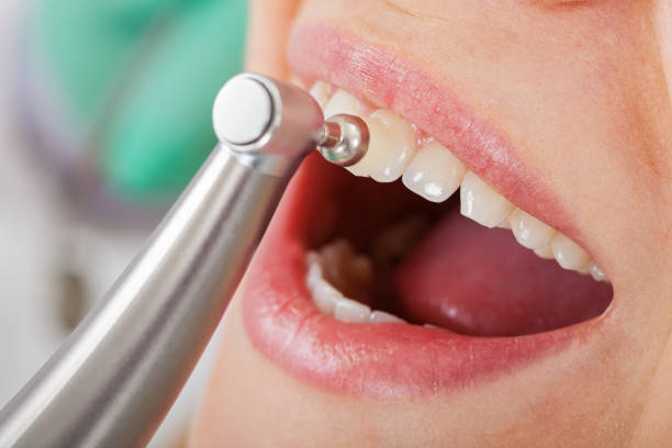 istock Professional dental cleaning 920427058