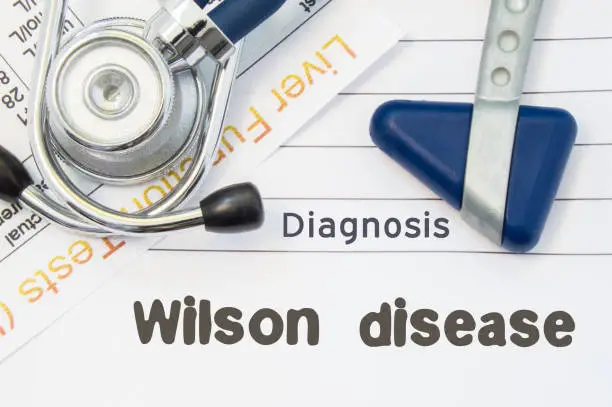 Diagnosis Wilson Disease. Neurological hammer, stethoscope and liver laboratory test lie on note with title of Wilson Disease. Concept for neurology and gastroenterology