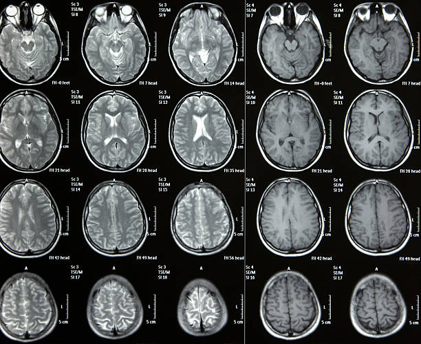 Mri Scan Rresults Mri Results Stock Photos, Pictures & Royalty-Free Images - iStock