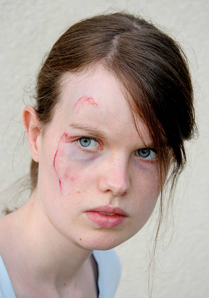 istock Injured woman 2 92047623