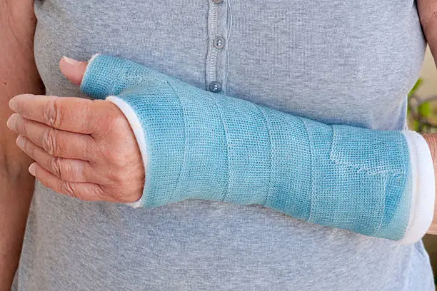 Photo of Close-up of woman's arm in blue cast