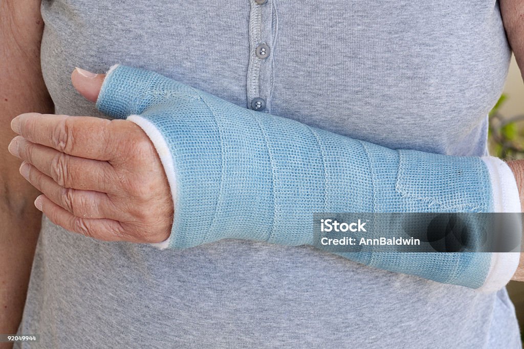 Close-up do braço de mulher em tom azul - Foto de stock de Gesso royalty-free