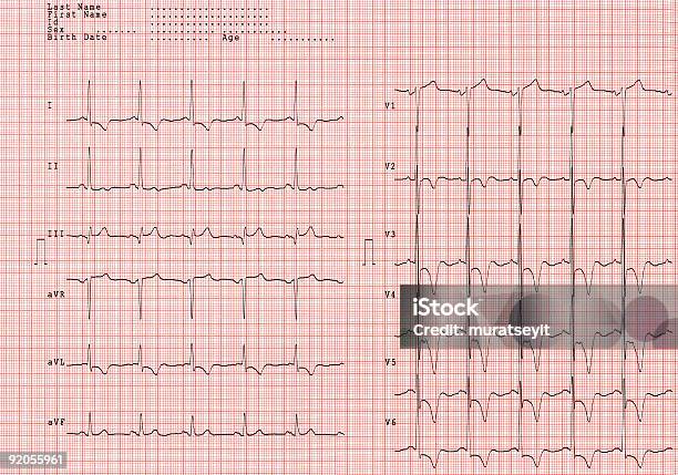 Foto de Ecg Série Xxl e mais fotos de stock de Desenho de Ondas - Desenho de Ondas, Fotografia - Imagem, Horizontal