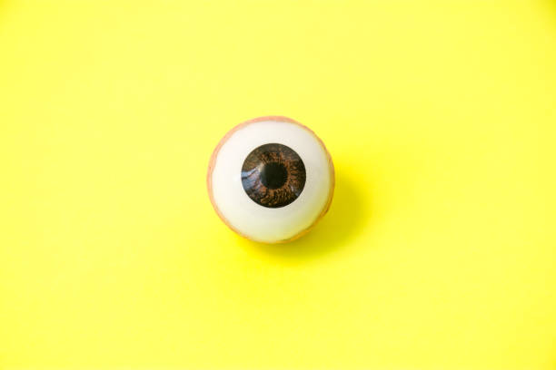 황 달 또는 icterus-눈 개념 사진에서 간 질환의 증상 발현. 인간의 눈의 해 부 모델 노란색 배경 그리고 sclera 반영 노란 색상 - sclera 뉴스 사진 이미지