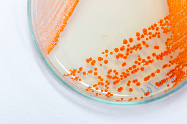 serratia marcescens is a species of rod-shaped gram-negative bacteria in the family enterobacteriaceae for laboratory microbiology. - bacterial colonies imagens e fotografias de stock