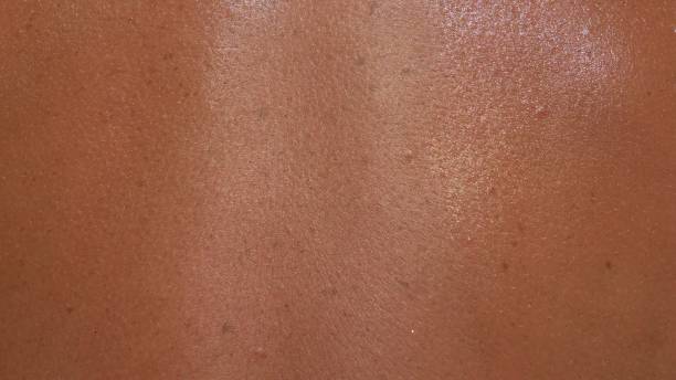 The skin is scorched in the sun with in macro. stock photo