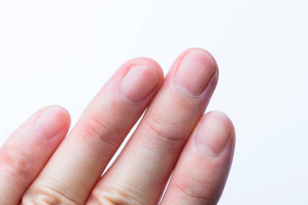 Human Hand, Human Skin, Beauty Product, Fingernail, Manicure