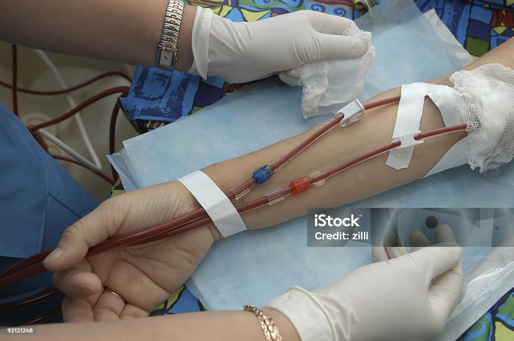 Manutenção hemodialysis - Foto de stock de Filtro de Diálise royalty-free