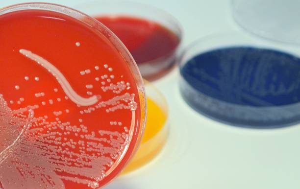 Staphylocuccus aureus, MRSA Staphylocuccus aureus is often the cause of wound infections following surgery. aureus stock pictures, royalty-free photos & images