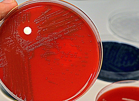 Streptococcus pneumoniae causes pneumonia, sepsis and meningis