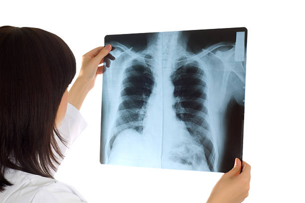 istock Female doctor looking at x-ray image on white 92134944