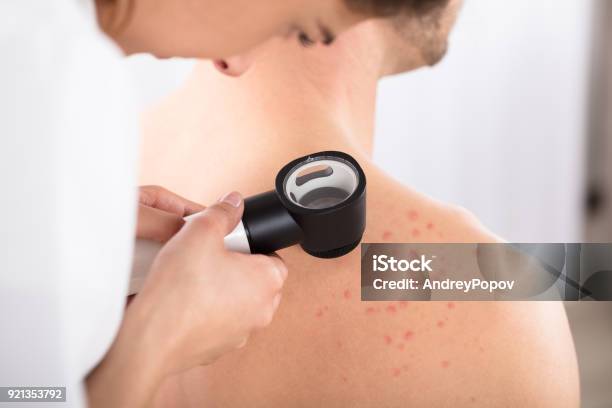 Doctor Using Dermatoscope For Skin Examination Stock Photo - Download Image Now - Skin, Dermatology, Doctor