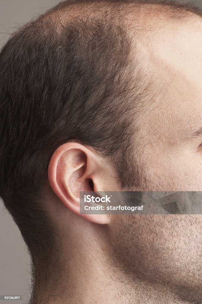 Zbliżenie z męskich ucha - Zbiór zdjęć royalty-free (Audiometrysta)