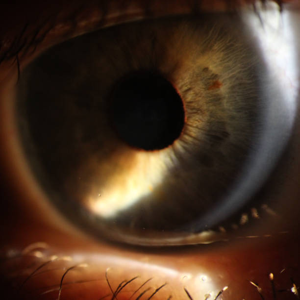 istock enlarged image of an eye iris made with a slit lamp 921364944