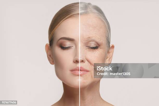 Comparison Portrait Of Beautiful Woman With Problem And Clean Skin Aging And Youth Concept Beauty Treatment Stock Photo - Download Image Now