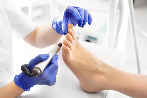Photo of Medical pedicure. Podologist develops feet with a milling machine.