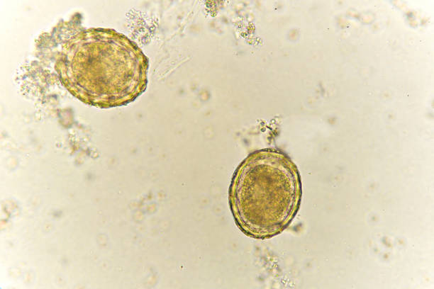 istock Egg of Ascaris lumbricoides in stool 921817002