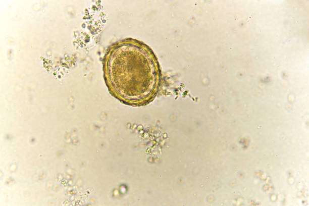 istock Egg of Ascaris lumbricoides in stool 921817038