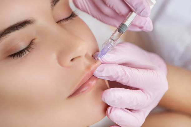 врач-косметолог делает процедуру увеличения губ красивой женщины в салоне красоты - health spa стоковые фото и изображения