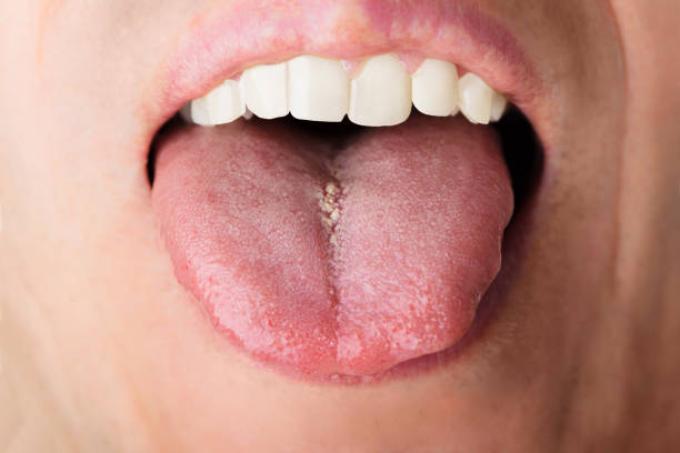 istock Man Showing Tongue 922102314