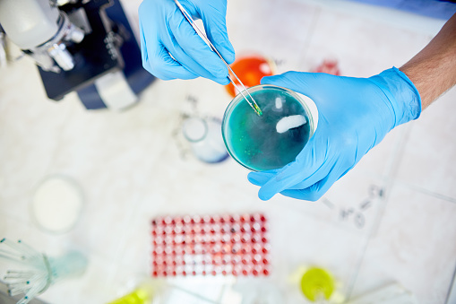 Directly above view of unrecognizable scientist in protective gloves using tweezers while adding reagent to petri dish with blue liquids while holding experiment in laboratory