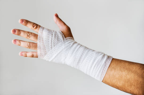 closeup of arm wrapped with medical gauze - bandage imagens e fotografias de stock