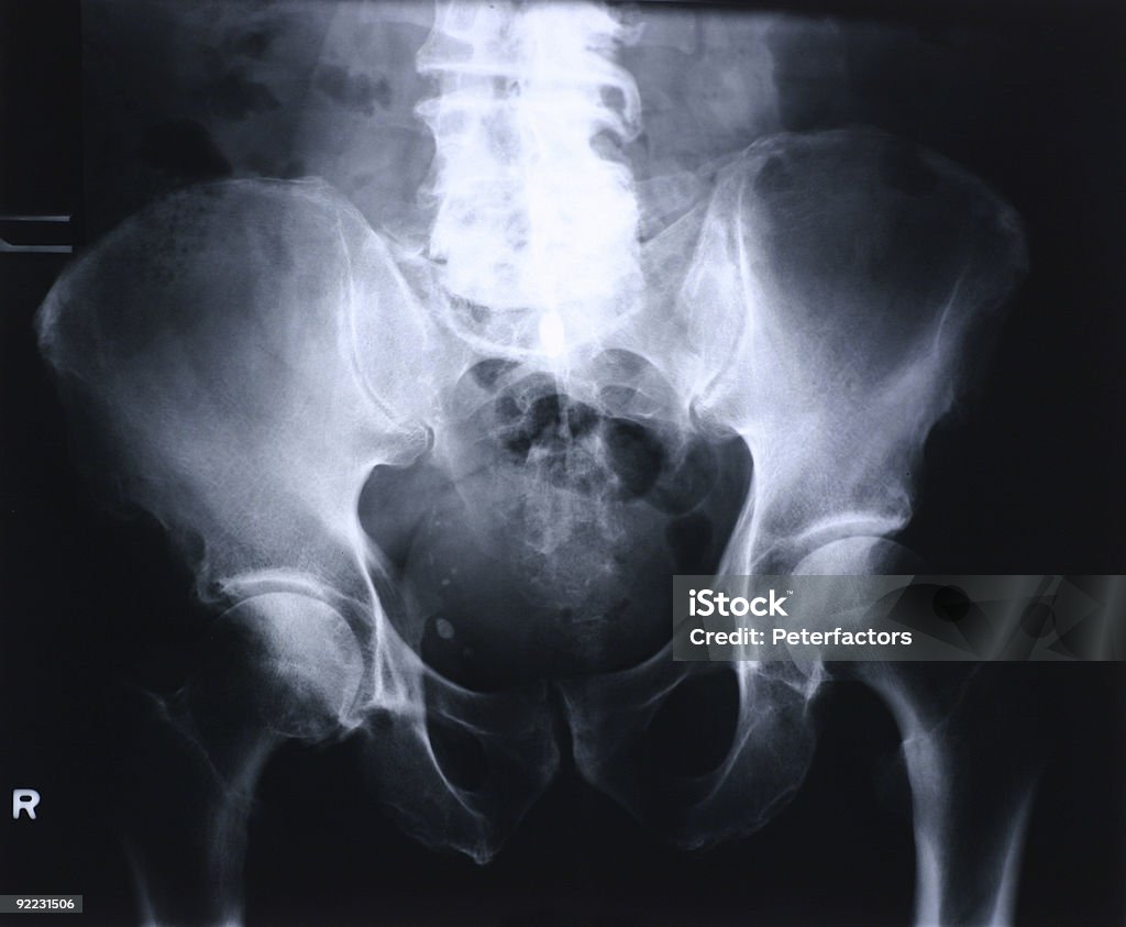 Xray de moda - Foto de stock de Guay libre de derechos