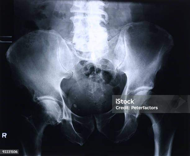 Xray De Moda Foto de stock y más banco de imágenes de Guay - Guay, Cadera, Toma eléctrica