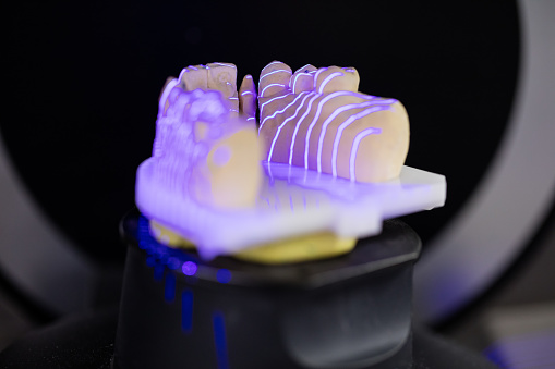 3D scanning of dentures