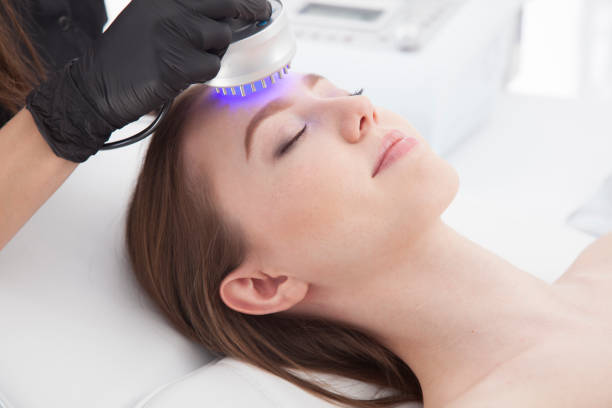 fototerapia. la procedura clinica che rende la pelle più lucida, liscia e pulita. - laser therapy medical laser light therapy foto e immagini stock