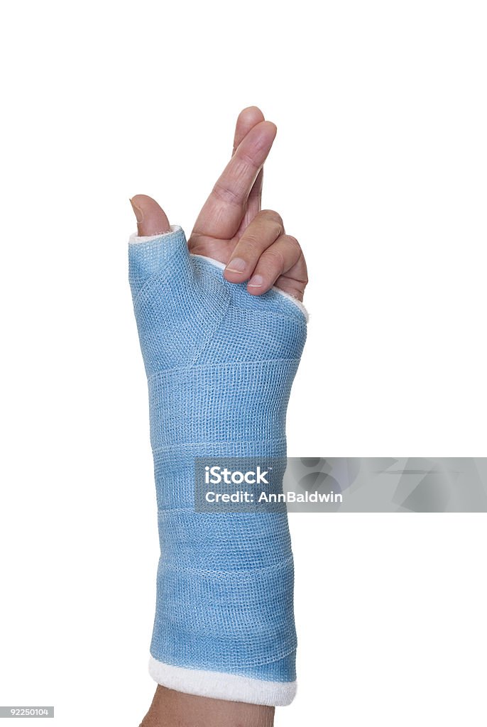 Left arm in cast with fingers crossed for luck.  Broken Arm Stock Photo