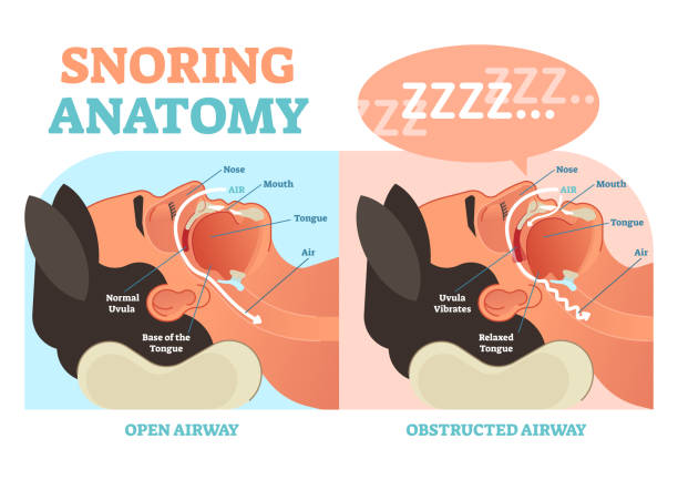 ilustrações, clipart, desenhos animados e ícones de ronco diagrama do vetor médica anatomia com passagem de ar. - snorting