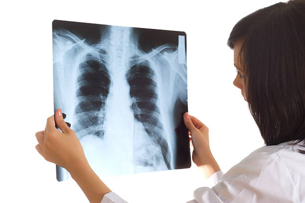 istock Female doctor looking at x-ray image on white 92264255