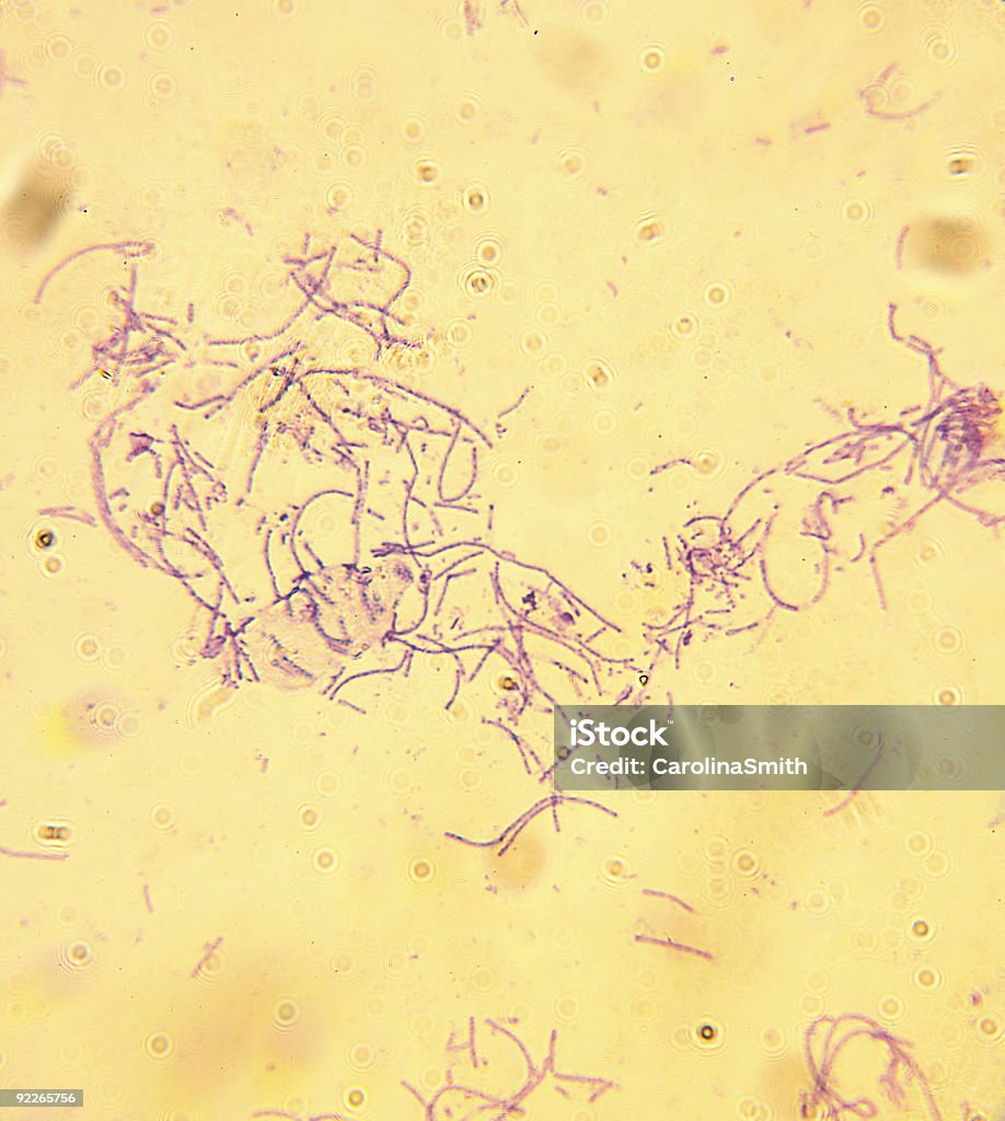 Microscope-Anthrax-Bacillus anthracis  Mail Stock Photo