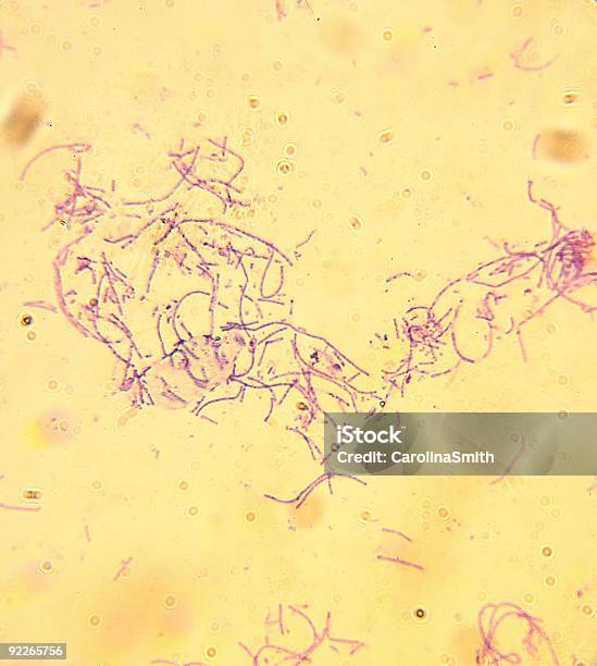 Microscopeanthraxbacillus Anthracis Stock Photo - Download Image Now - Mail, Bacillus Subtilis, Bacterium