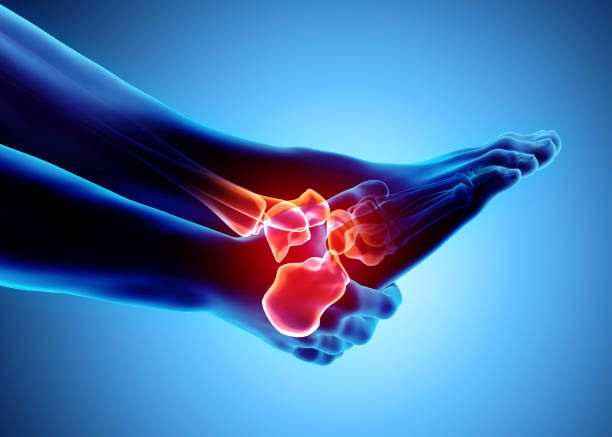 istock Ankle painful - skeleton x-ray. 922707138